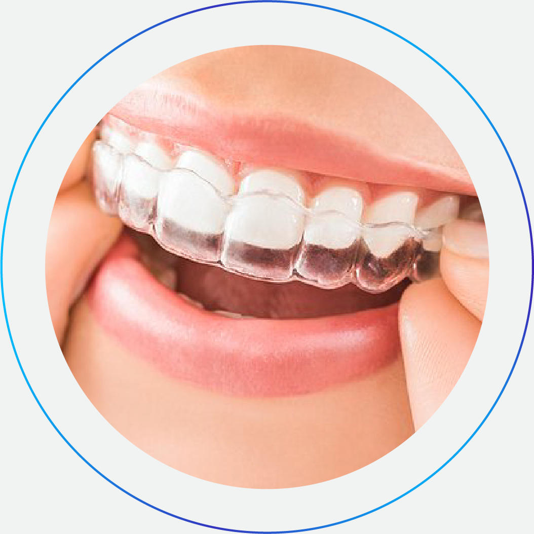 Ορθοδοντικός Invisalign Χαλάνδρι