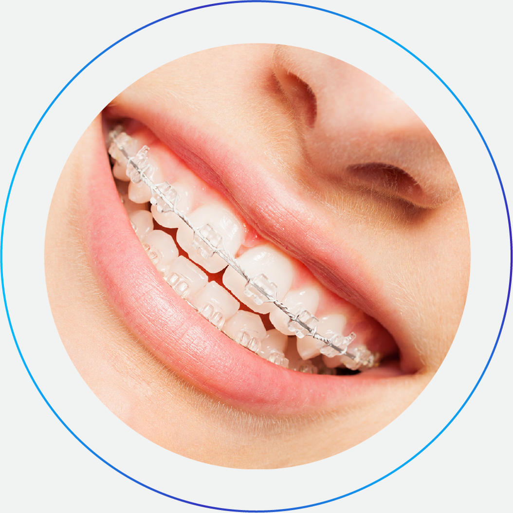 Ορθοδοντικός Invisalign Χαλάνδρι