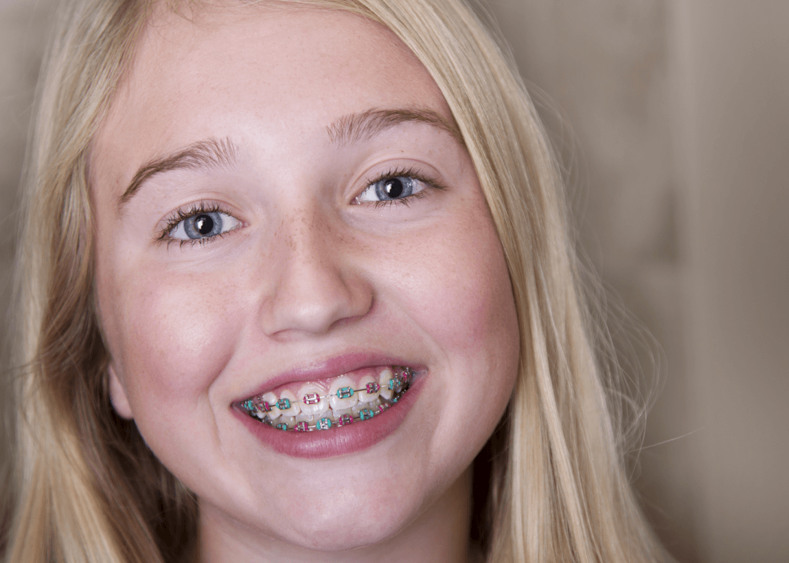 Orthodontic treatment for teenagers